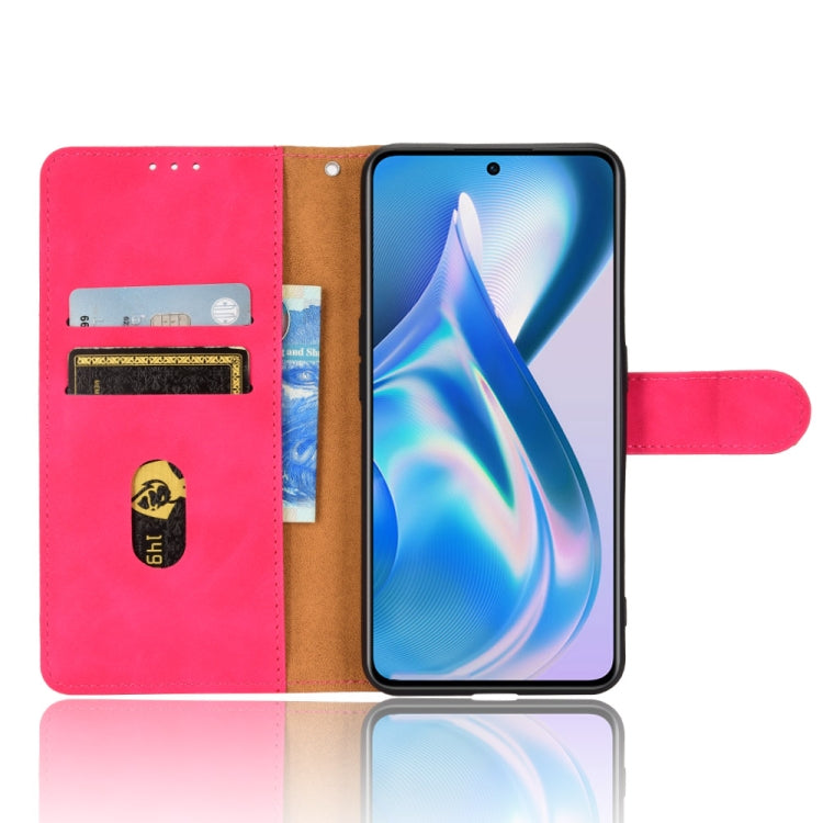 EDA003090401D_3.jpg@29b9a3b63da6805701b7cad3c3e9618c